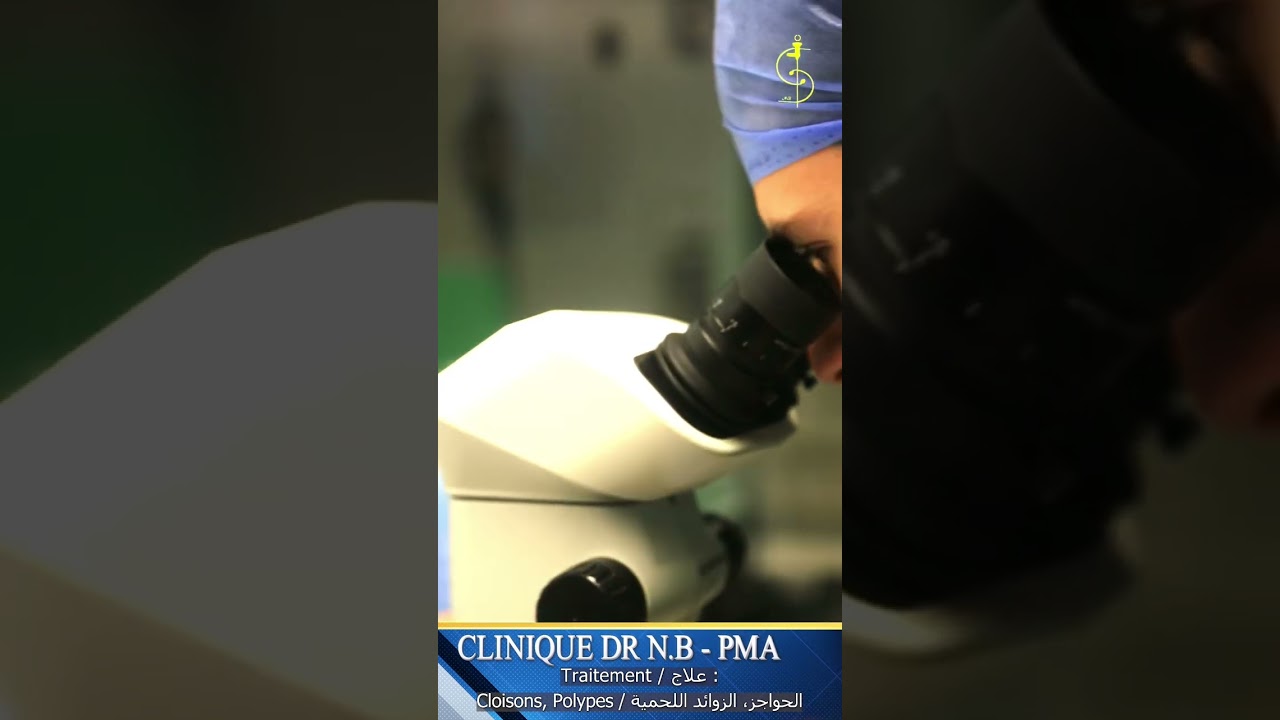 fécondation in vitro