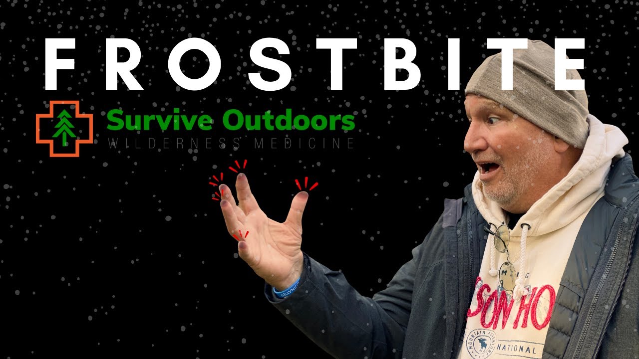What are the Most Common Cold Weather Injuries - Chilblains and Frostbite