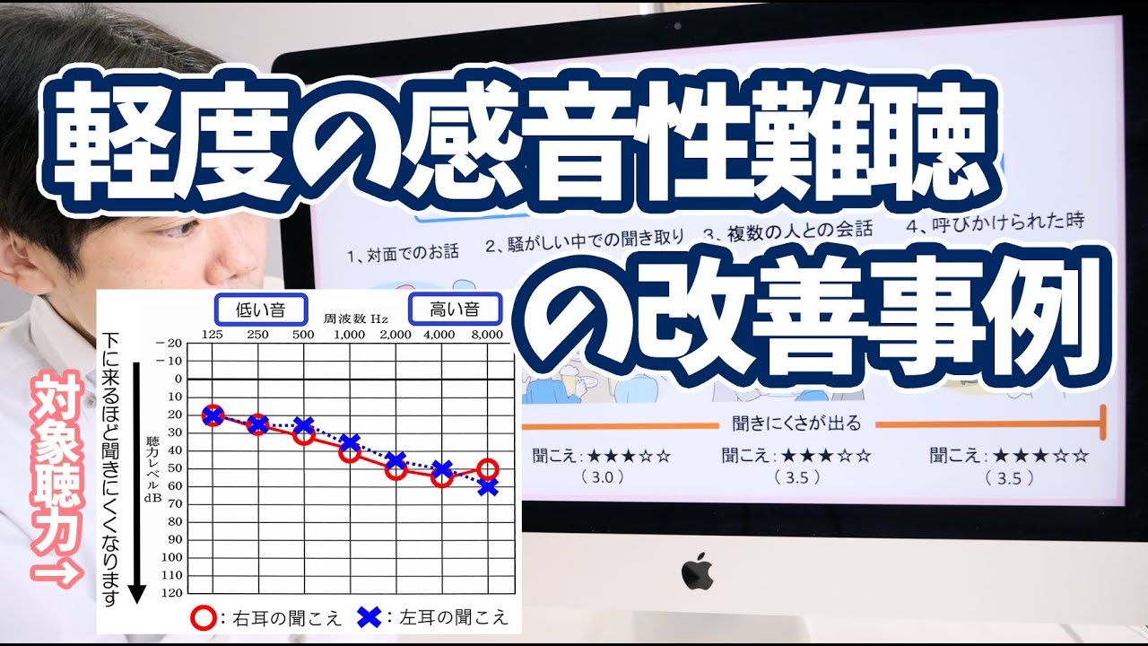 【改善事例】30代・軽度の感音性難聴の方、補聴器で聞こえを改善・前編