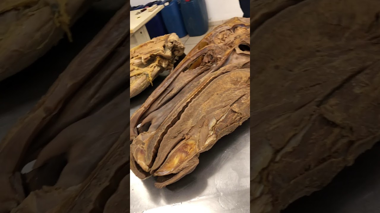 CAVIDADE NASAL