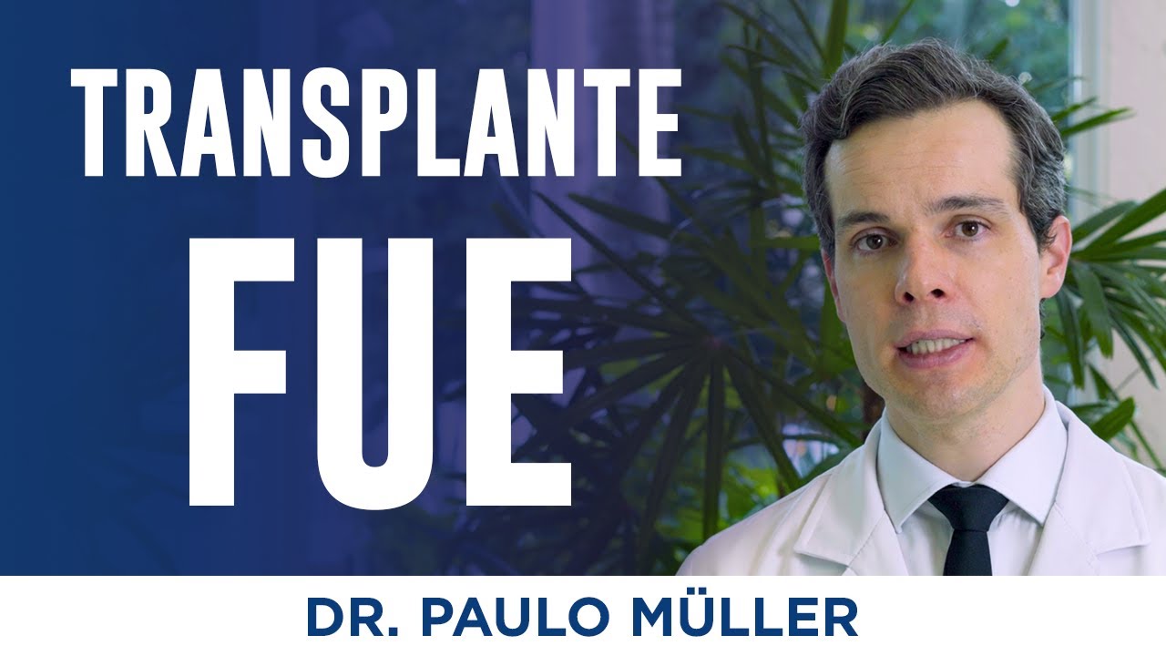 Como é feito o Transplante Capilar na técnica FUE - Dr. Paulo Müller Dermatologista