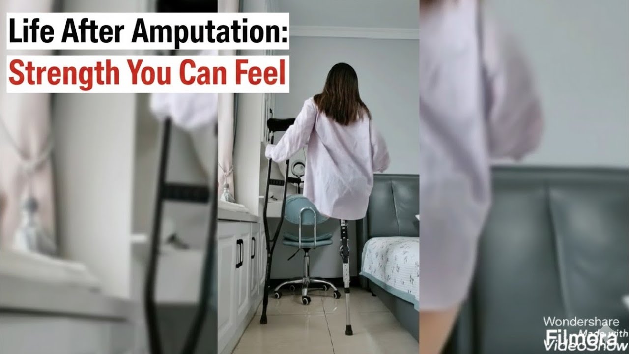 Living Confident with One Leg | Real Amputee Life Story