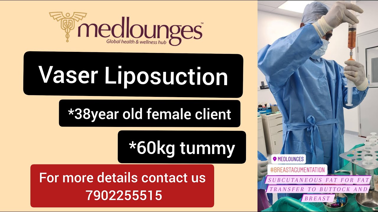 Vaser Lipo @Medlounges | Dr. Joseph Thomas