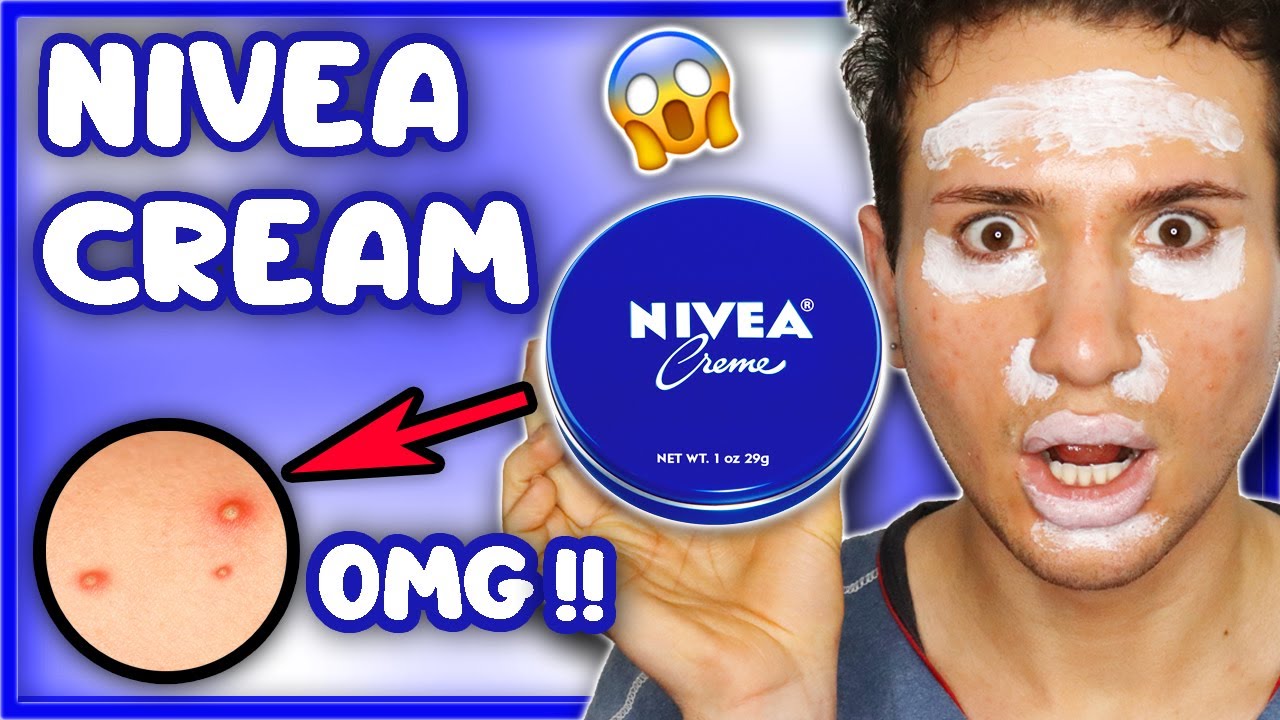 INFAMOUS NIVEA CREAM REVIEW: Can people with OILY ACNE PRONE SKIN can use it TOO?