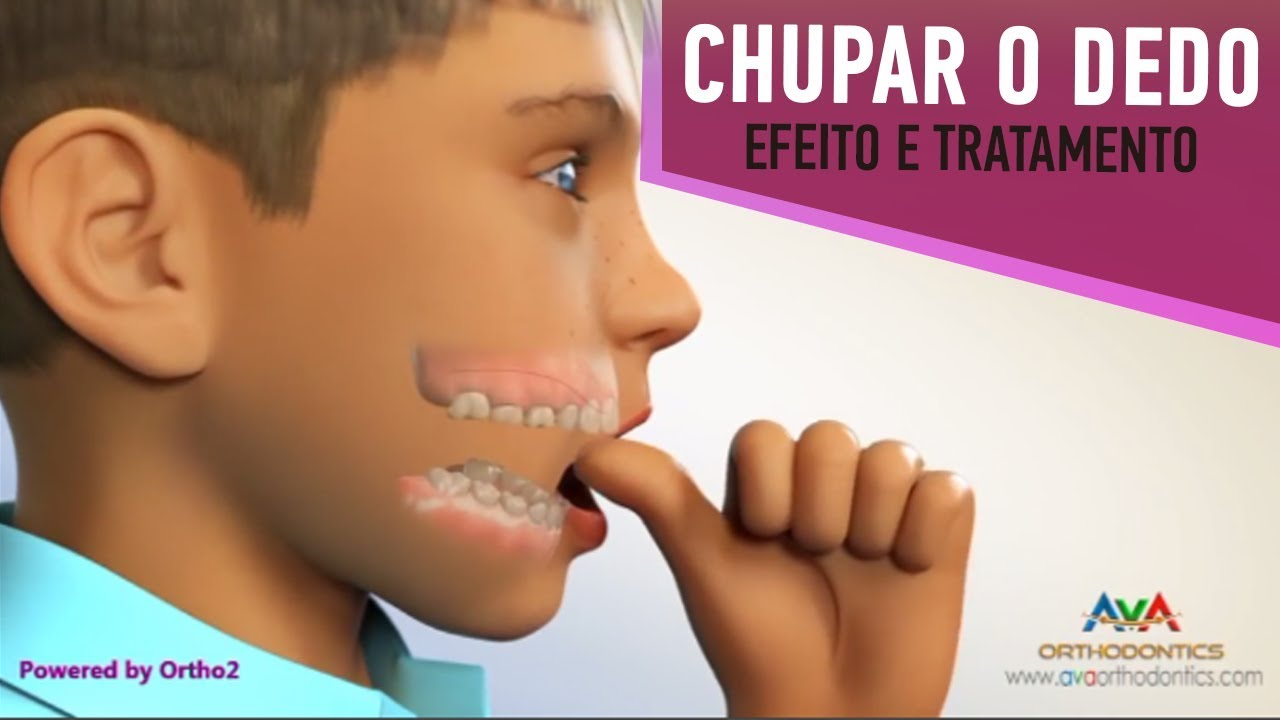 Seu Filho Chupa o Dedo?