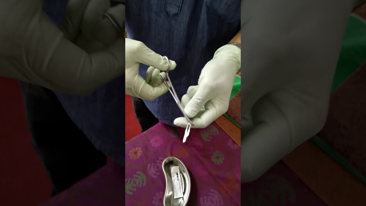 Cara memasang pisau bedah pada scalpel