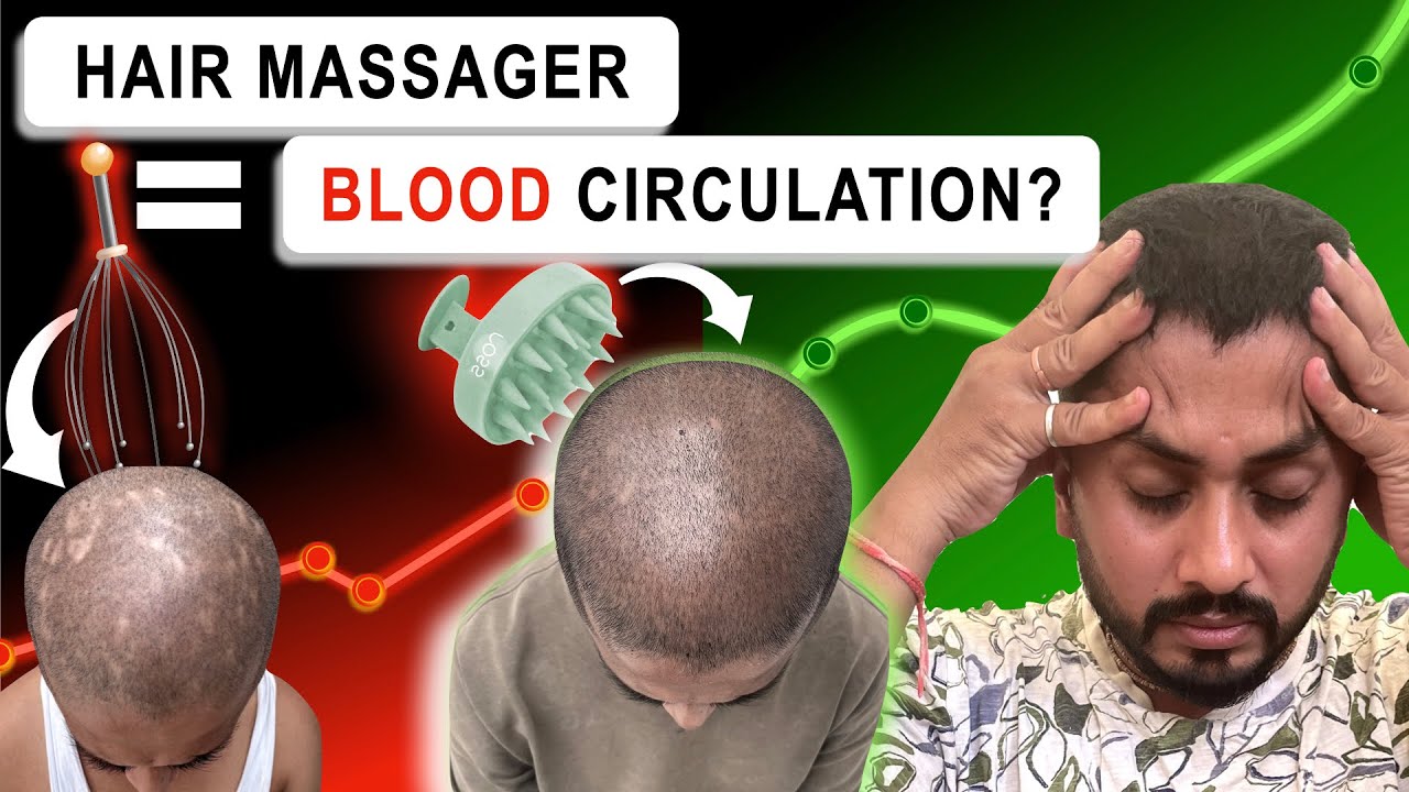 Hair Massager से Blood Circulation और Hair Growth Possible!! 😳