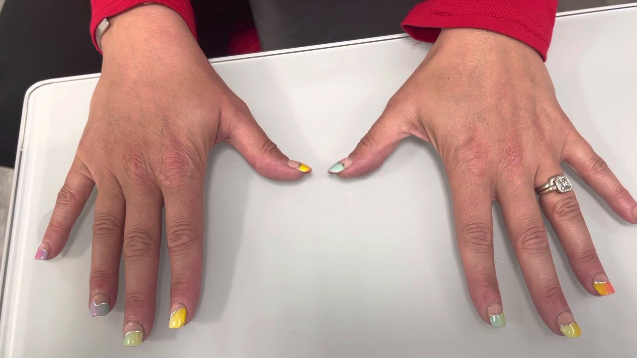 Thumb CMC joint replacement