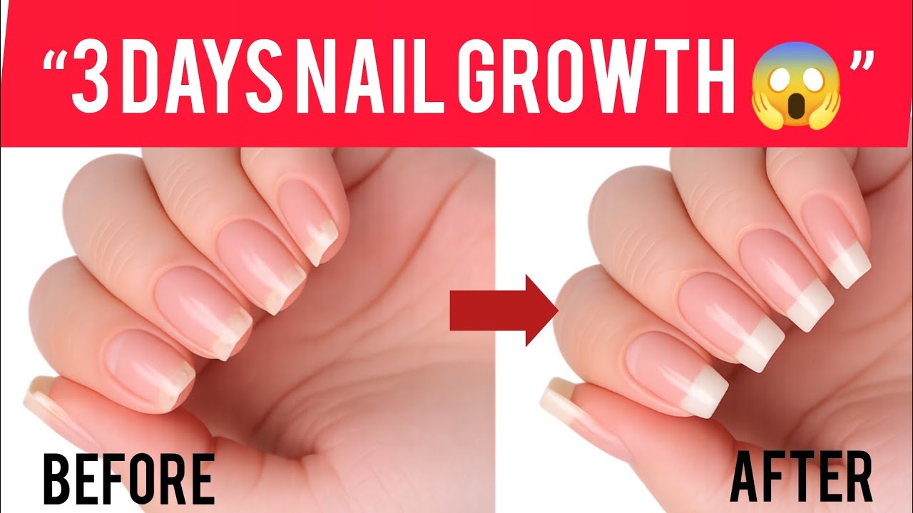 grow nails in just 3 days || faster nail growth tips || how to nails grow fast in one day