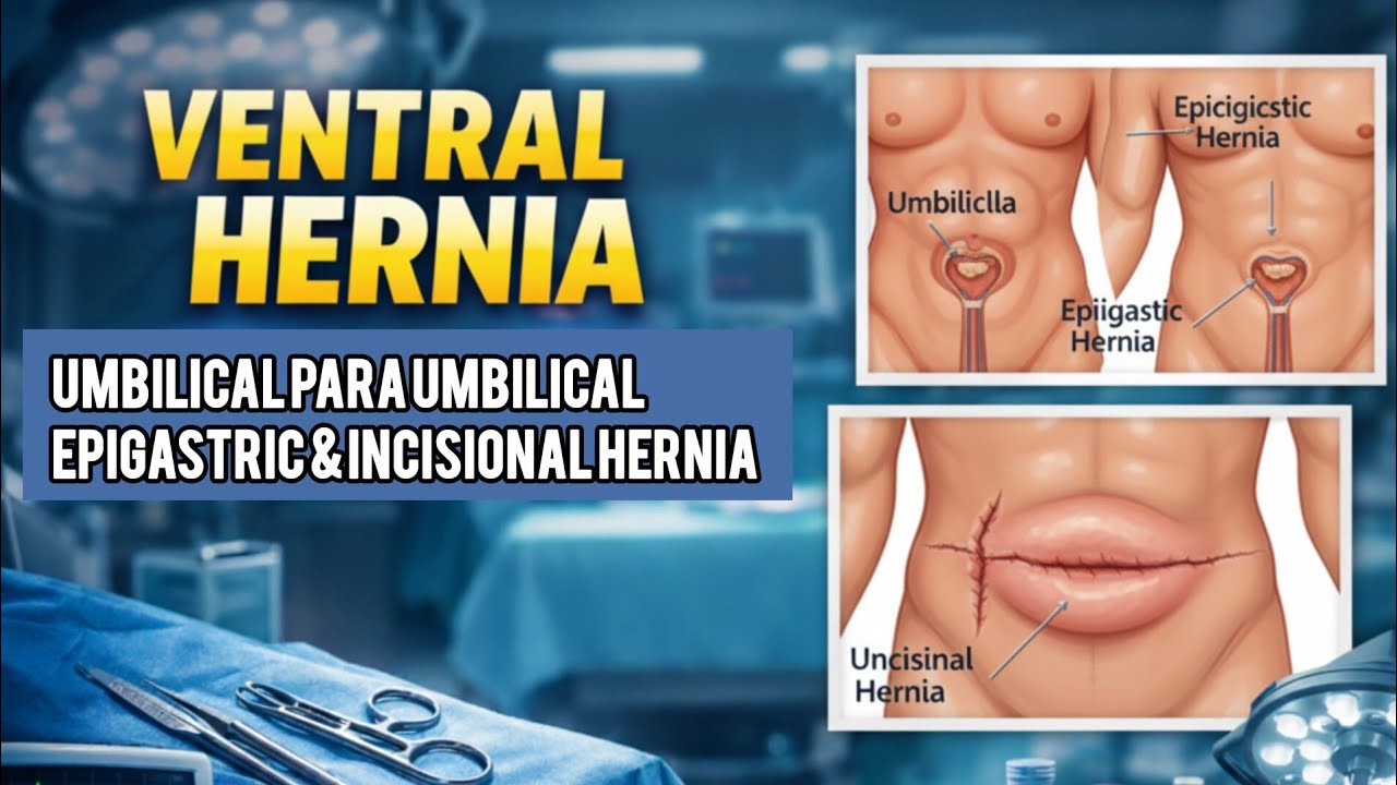 Ventral Hernias Explained | General Surgery Lecture | Types, Causes & Management