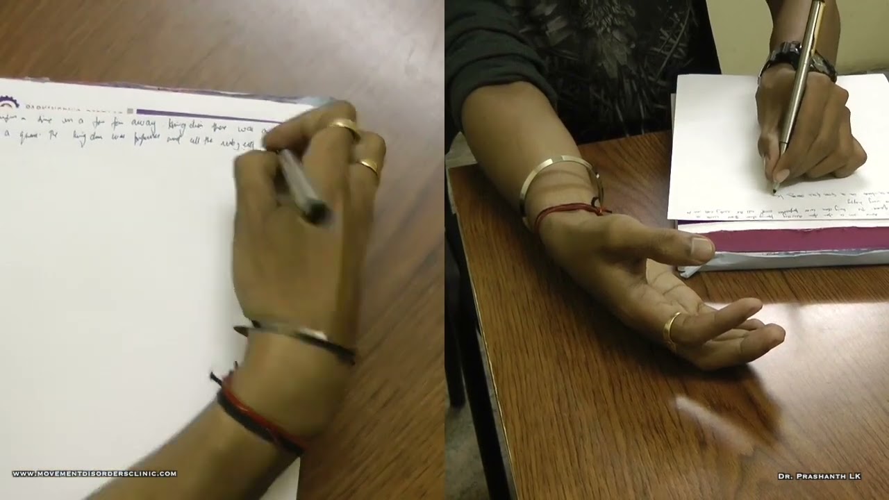 Writer's Cramp : Flexion type