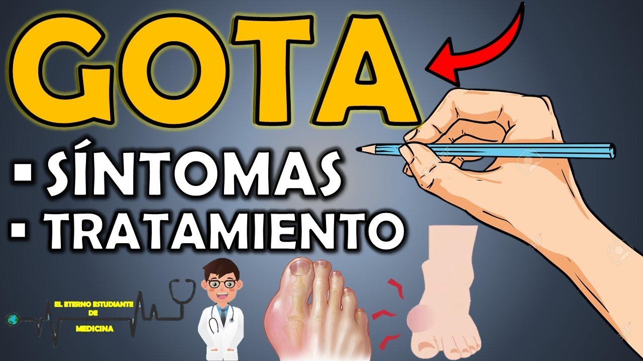 ¿QUÉ ES LA GOTA y cuáles son los SÍNTOMAS? Tratamiento