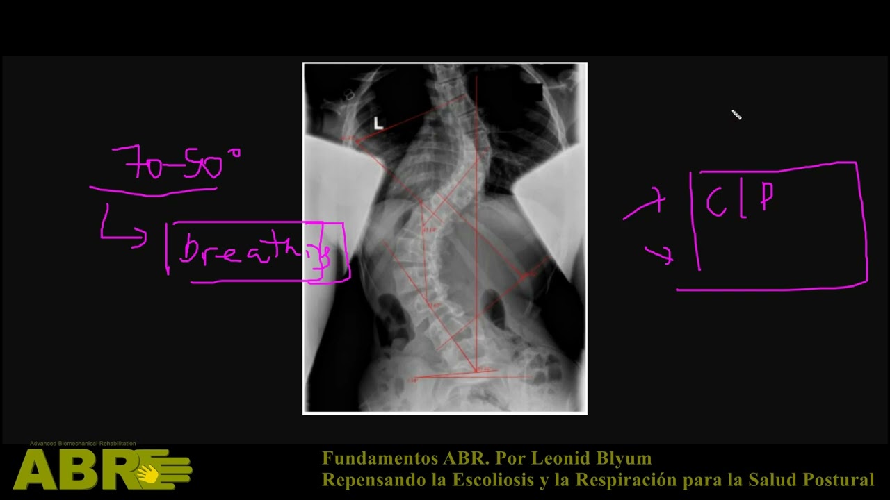 Fundamentos ABR - Repensando la Escoliosis y la Respiración para una mejor Postura. Por Leonid Blyum
