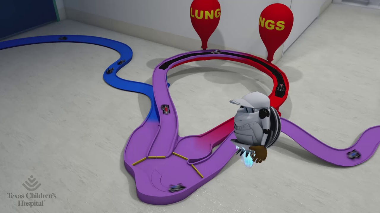 Double Inlet Ventricle: Pulmonary Artery Band
