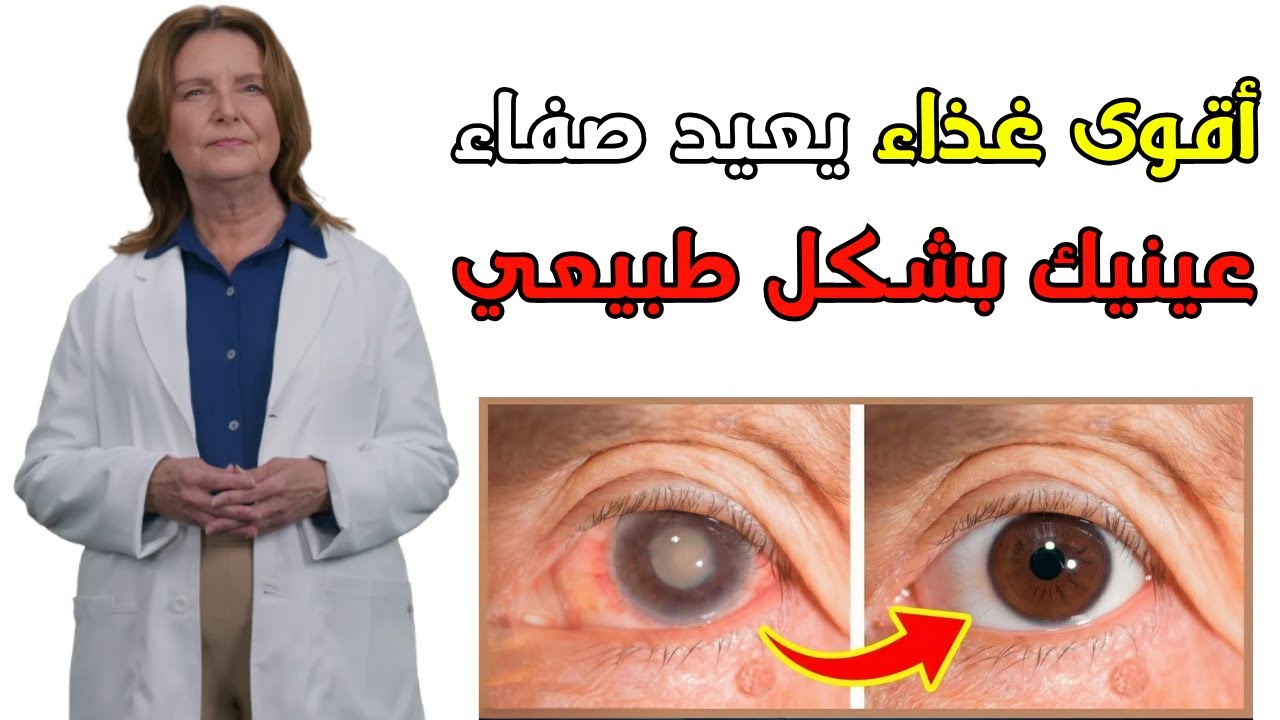 عاجل +60: الطعام الرخيص الذي يُزيل ضبابية الرؤية في غضون أسابيع!