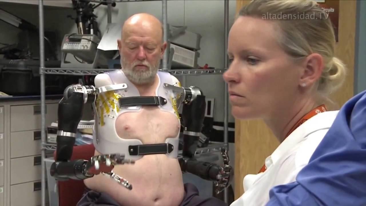 Asombrosa prótesis robótica doble que se controla con la mente +