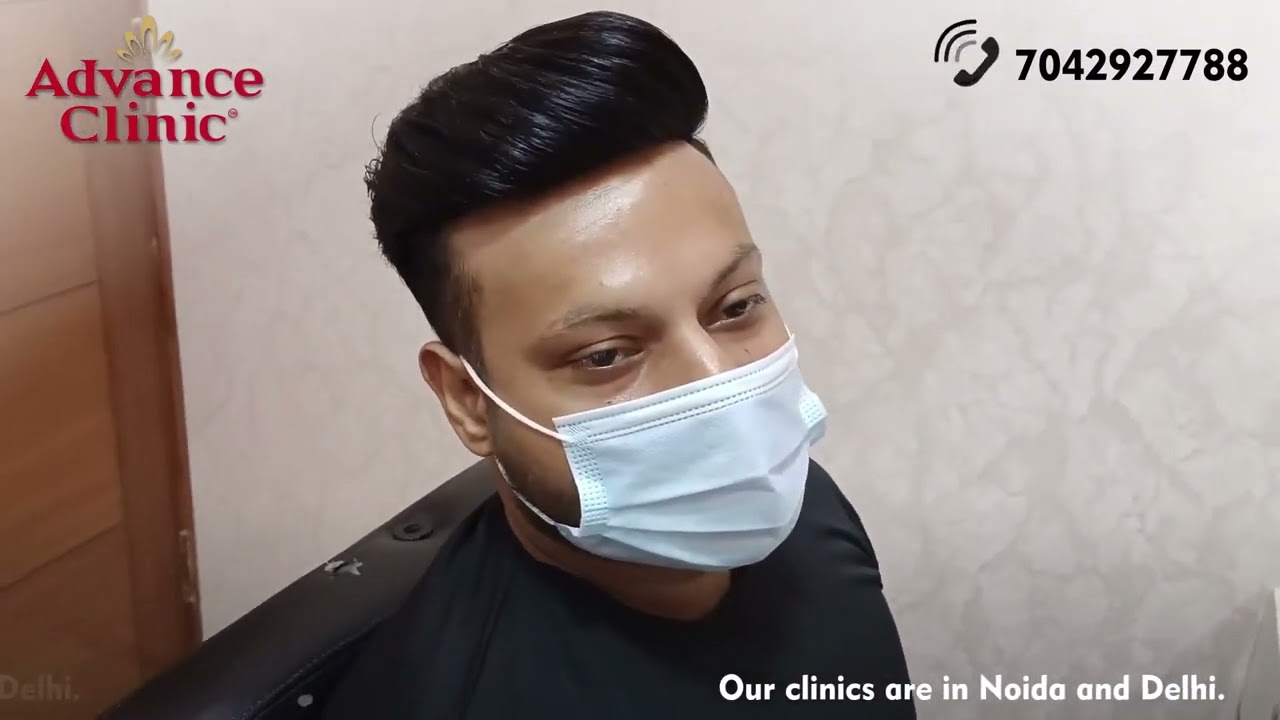 Hair Patch for Men: Instant Transformation & Natural Look | Advance Clinic