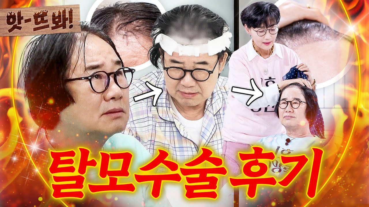 앗! 최양락 🔥모발 이식 수술 결과🔥 공개?!｜1호가 될 순 없어 2｜JTBC 250816 방송 외