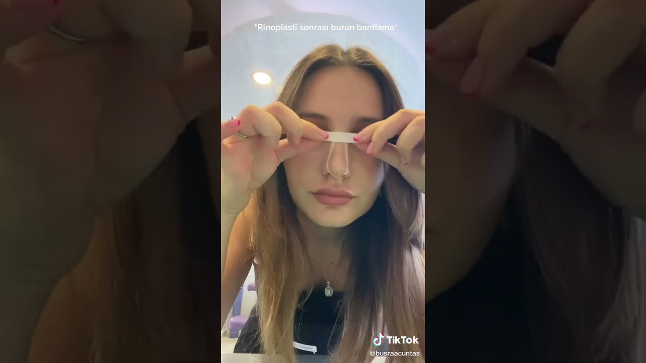 Rhinoplasty - burun ameliyatı sonrası burun bantlama.