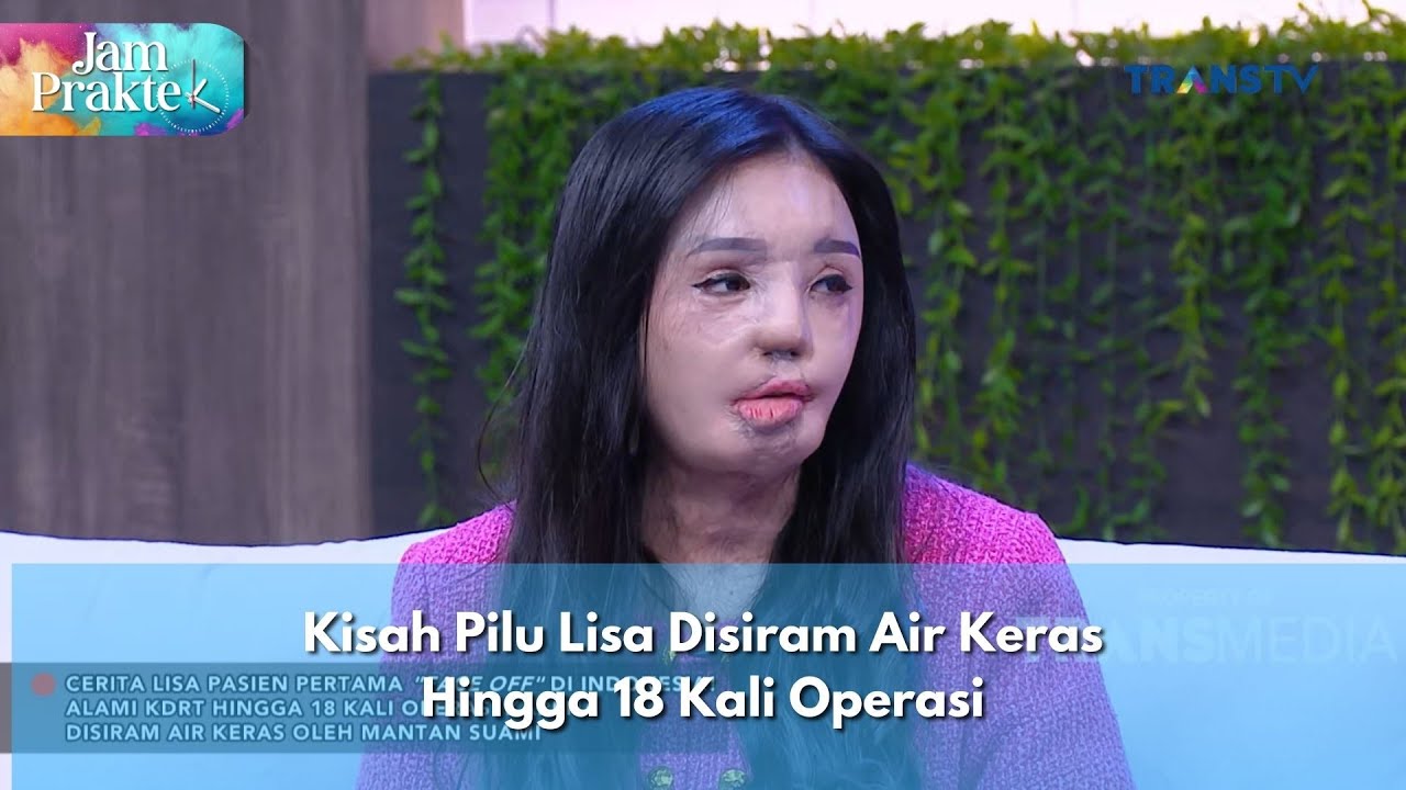 Kisah Pilu Lisa Disiram Air Keras Hingga 18 Kali Operasi - JAM PRAKTEK (14/1/25) P1