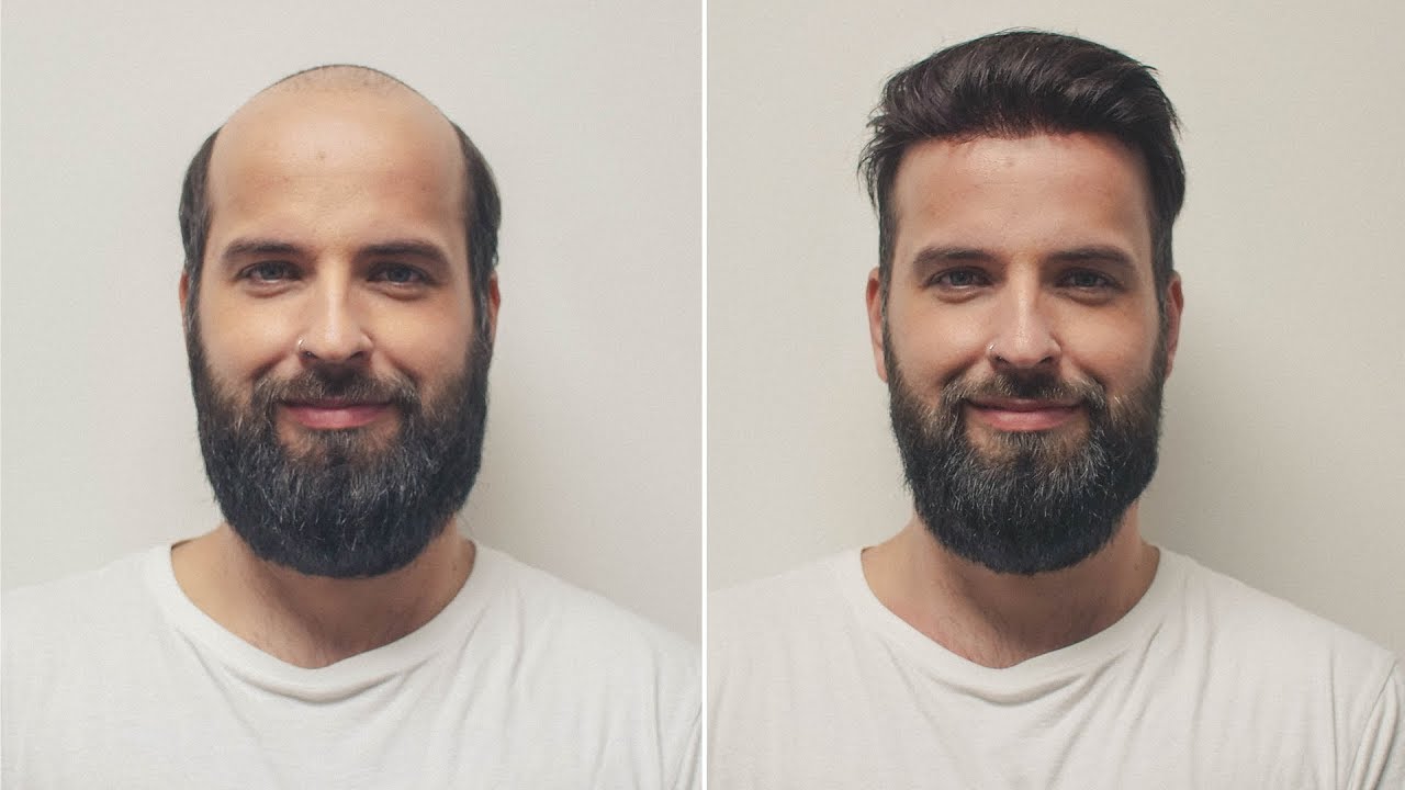 Barber Style Haircut | Hairstyle Transformation | Hairsystems Heydecke