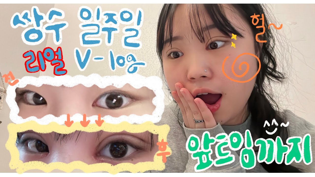 VLOG  일주일 밀착 쌍수브이로그 | 징그러움 주의!