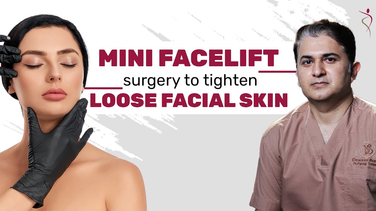 Mini Facelift Surgery to Tighten Loose Facial Skin | MACS Lift | Best Plastic Surgeon in Mumbai