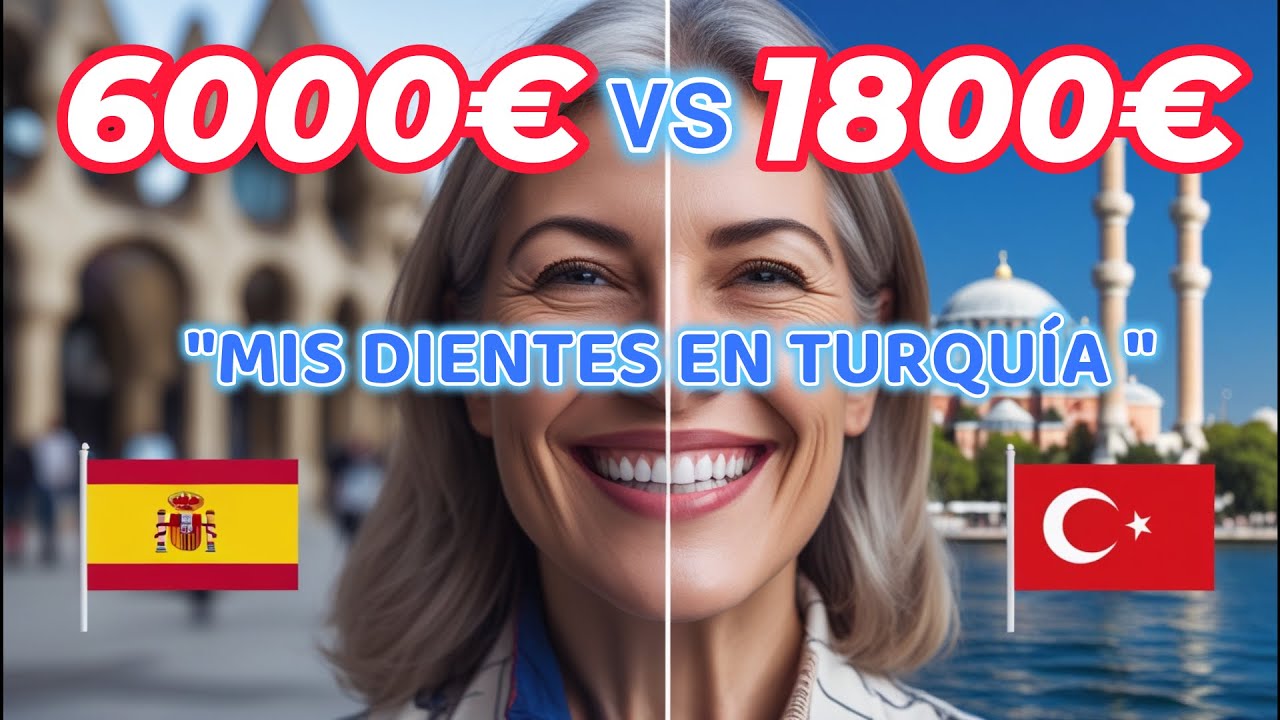MI MADRE SE PUSO DIENTES EN TURQUÍA 🦷✨ ¡ASÍ LE VA DESPUÉS DE 4 MESES!