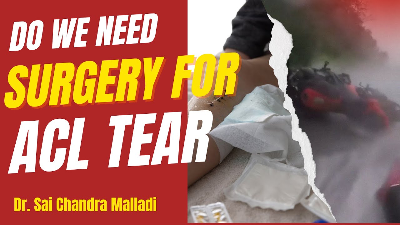 Do We Need Surgery For ACL Tear | Dr. Sai Chandra