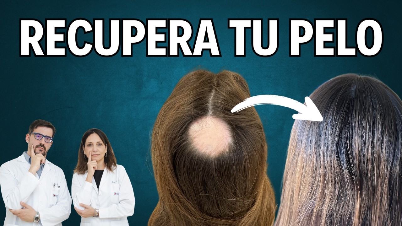 🔵 ALOPECIA AREATA: Causas, Síntomas y Tratamiento