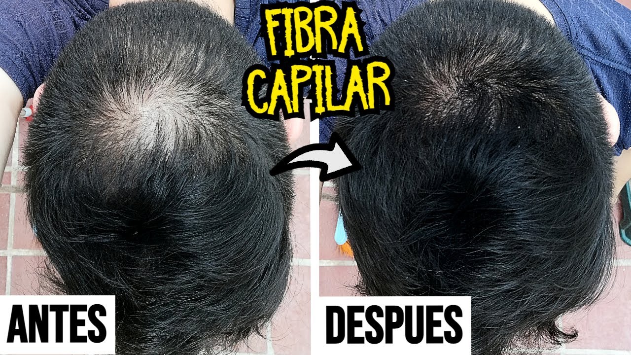 FIBRA CAPILAR Ventajas y Desventajas para la ALOPECIA &iexcl;2 MESES de USO! | LO QUE DEBES SABER