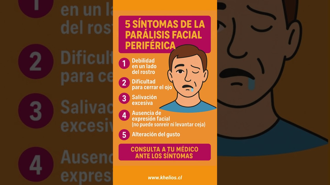 5 S&iacute;ntomas de Par&aacute;lisis Facial Perif&eacute;rica que Debes Reconocer a Tiempo