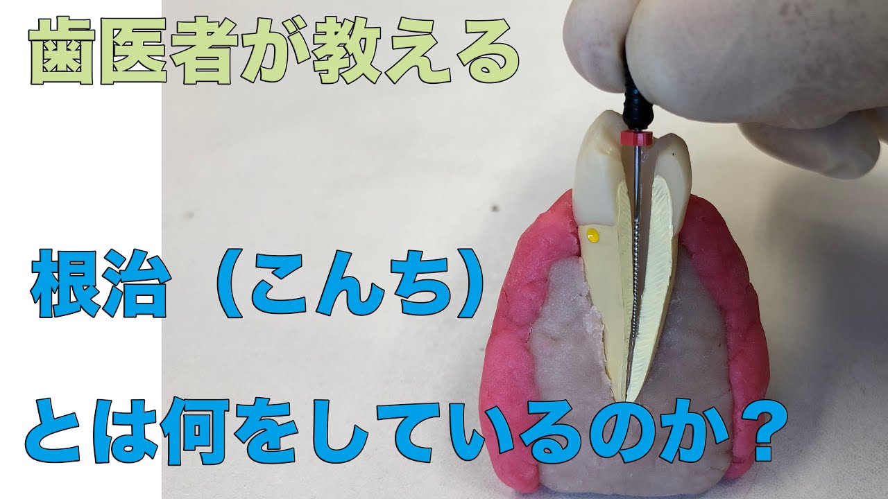 根治の説明動画① 根治とは何をしている治療なのか？