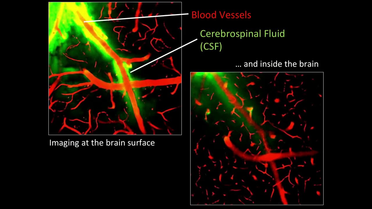 The brain&rsquo;s waste disposal system works at night
