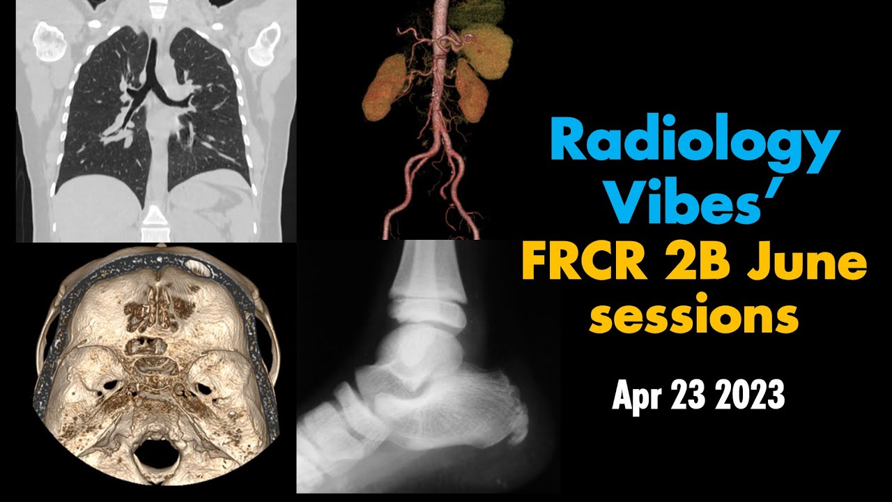 RadVibes FRCR 2B viva sessions - April 23 2023