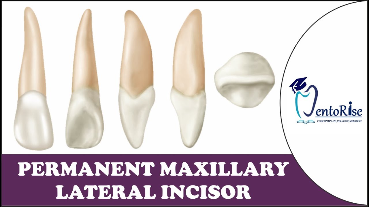 Permanent Maxillary Lateral Incisor | Tooth Morphology | Dental Anatomy