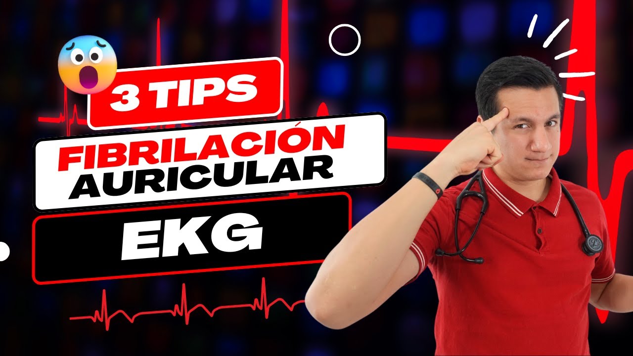 Diagnosticando Fibrilación auricular con respuesta ventricular rápida en el EKG