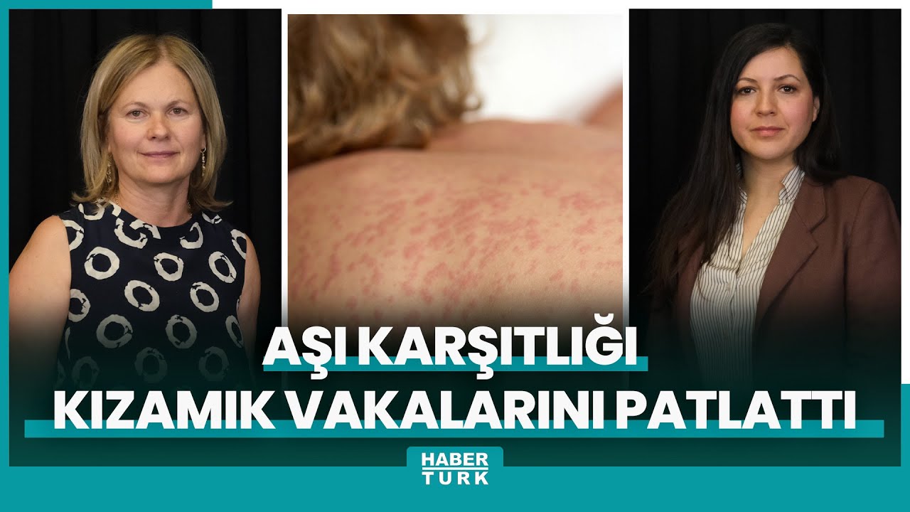 Aşı karşıtlığı kızamık vakalarını patlattı