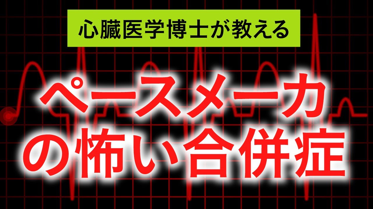 ペースメーカ治療の怖い合併症!!【それでも必要です!!】