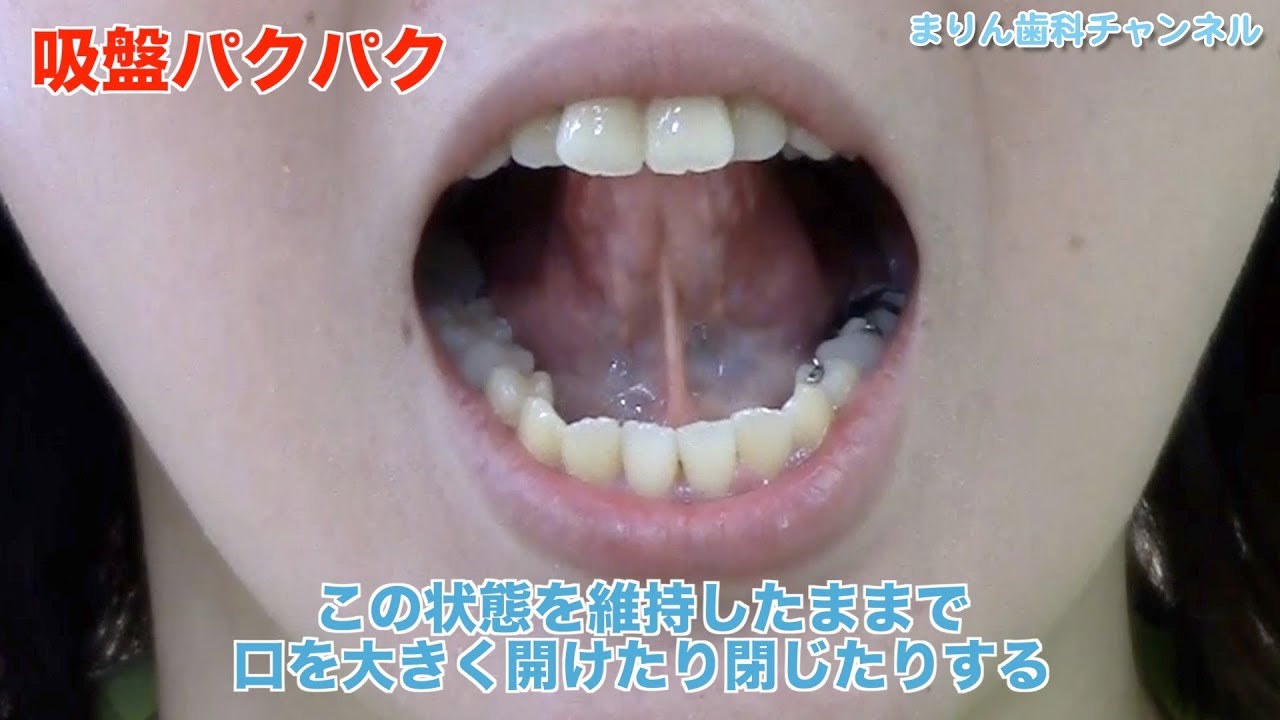 【小倉南区 門司区 歯医者】きれいな歯並びを作ろう！舌の位置修正トレーニング_まりん歯科チャンネル105（口腔ケアチャンネル）