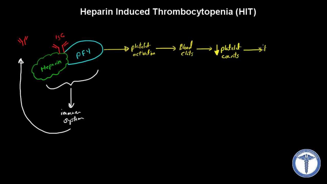 Heparin Induced Thrombocytopenia (HIT) Explained - MADE EASY