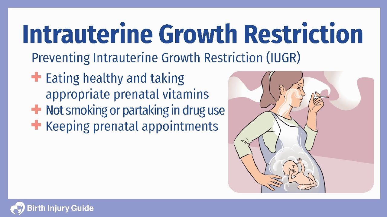 (IUGR)Intrauterine growth restriction ! cause! diagnostic! Treatment! explained !