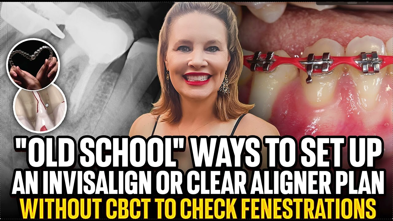 No CBCT? "Old School" ways of Monitoring Bone in Ortho for Braces and Invisalign Clear Aligners