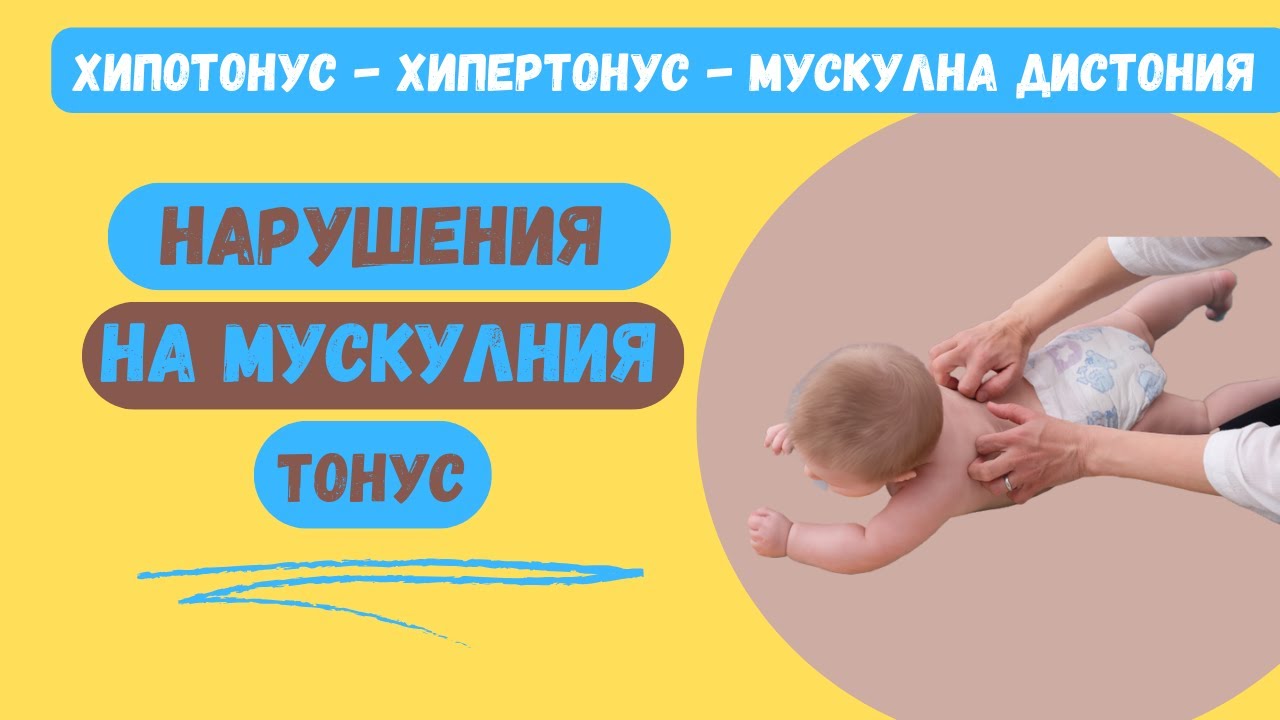 Нарушения на мускулния тонус