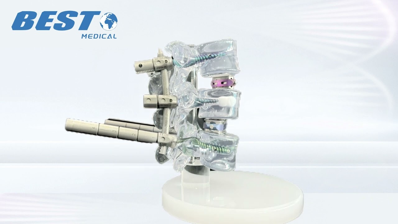 Transparent Resin Spine Model with Interbody Cage and Pedicle Screw System