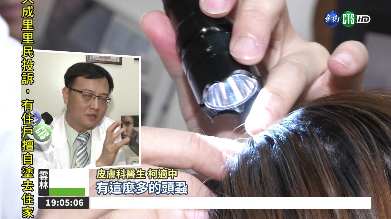 嚇壞媽媽了! 頭蝨爬滿女童頭
