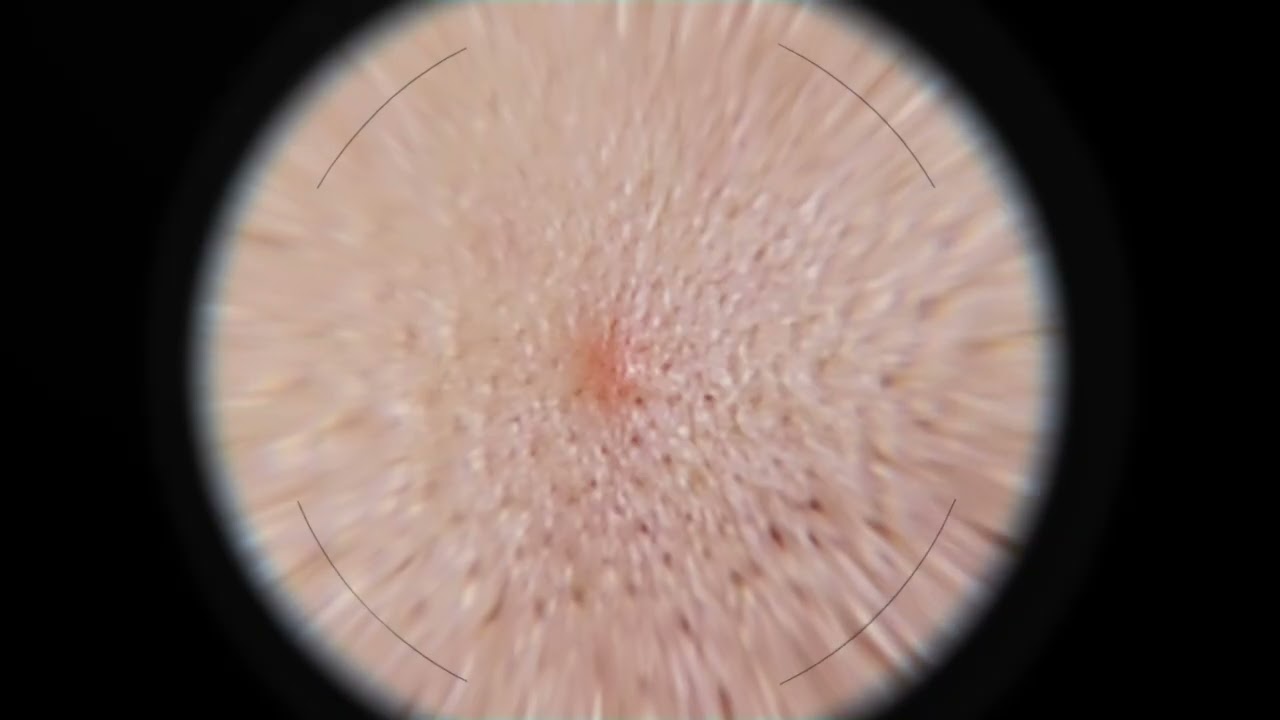 Mixa serum proti nepravilnostim