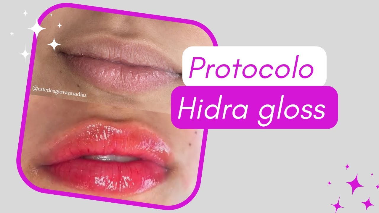 Protocolo Hidra gloss : Tulipia e Bel Col