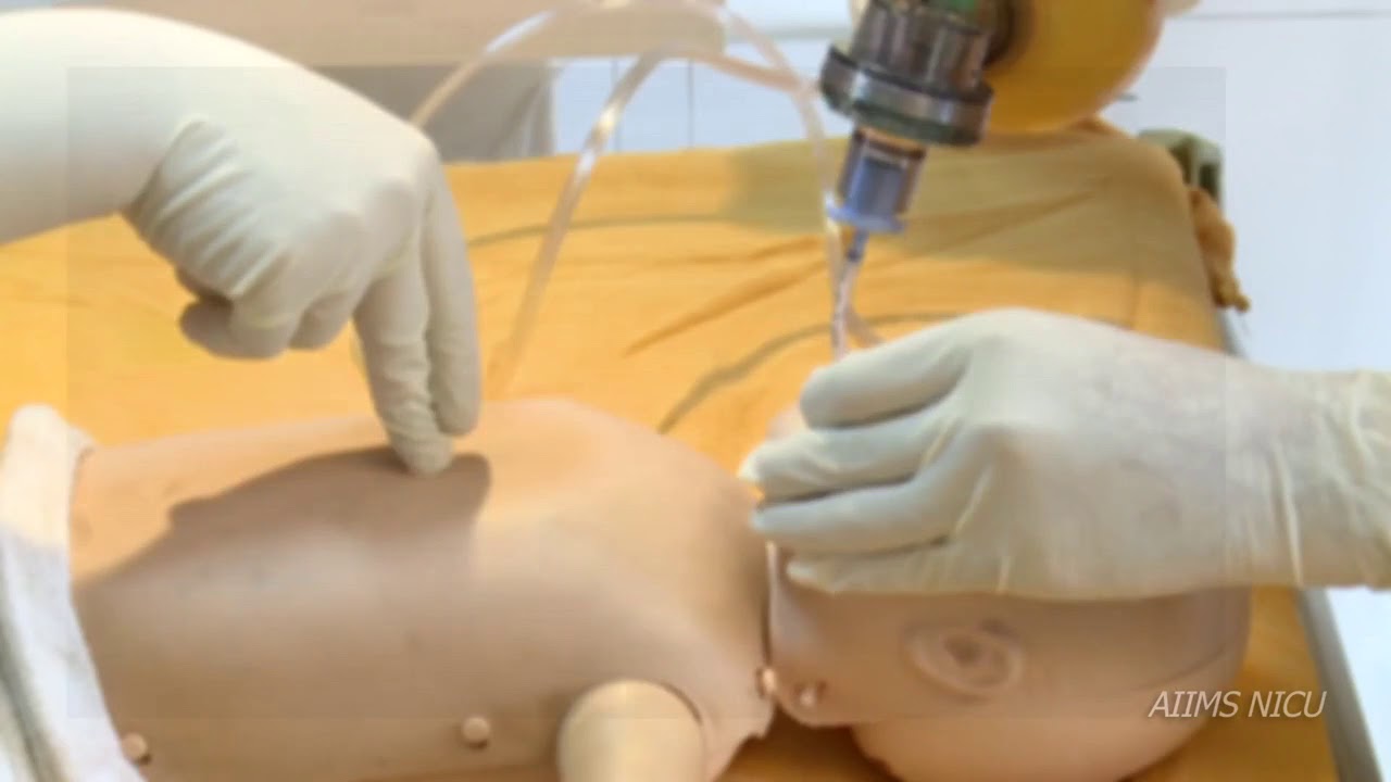 Chest compression