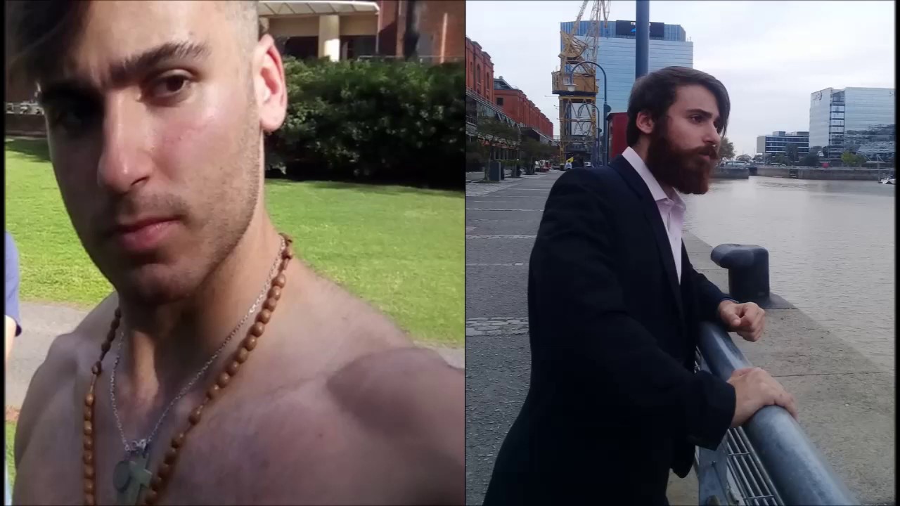 18 Year Old Teen Grows A Beard For 5 Months